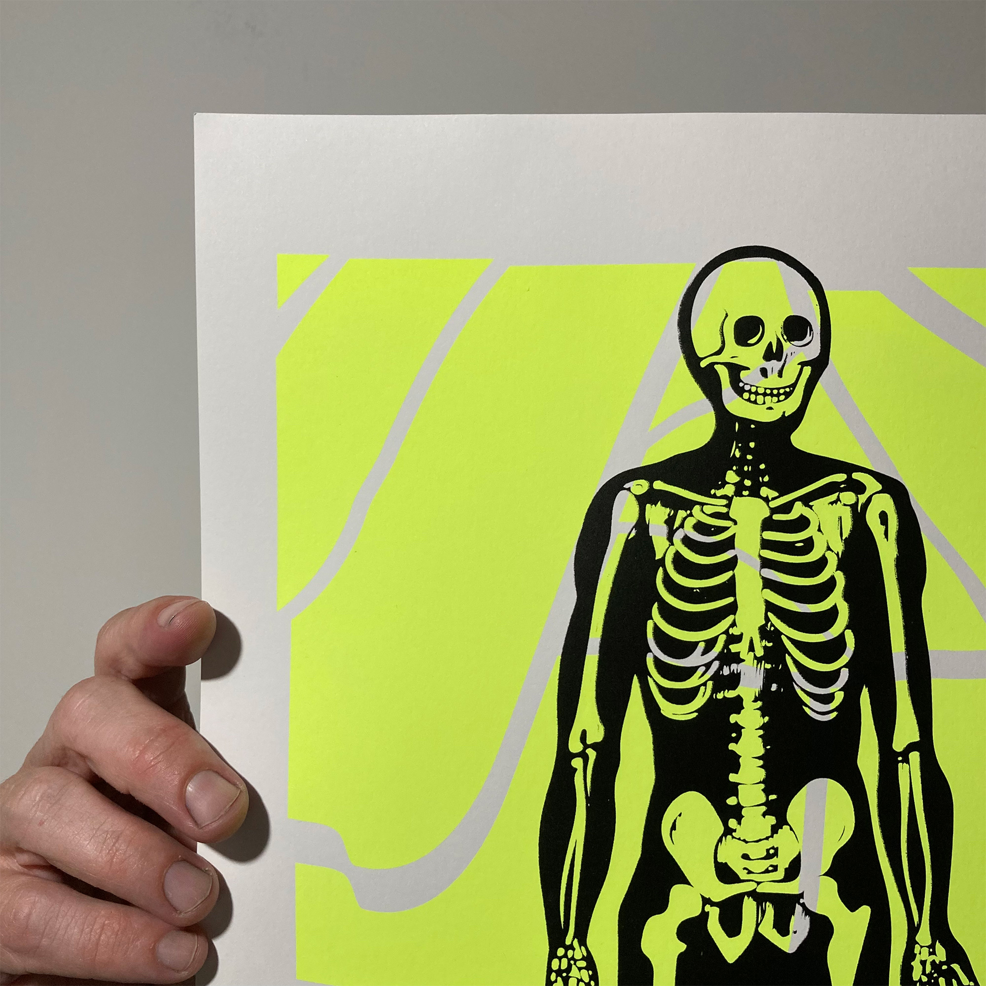 Screen Printed Poster - Acid Skeleton - Image 2